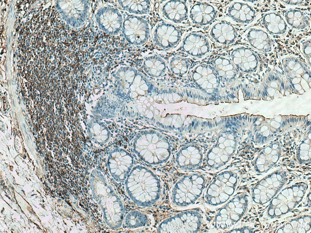 Immunohistochemistry (IHC) staining of human colon tissue using NT5E/CD73 Polyclonal antibody (12231-1-AP)