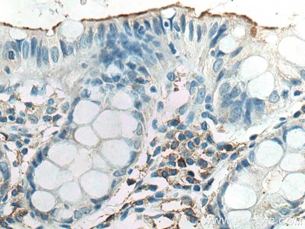 Immunohistochemistry (IHC) staining of human colon tissue using NT5E/CD73 Polyclonal antibody (12231-1-AP)