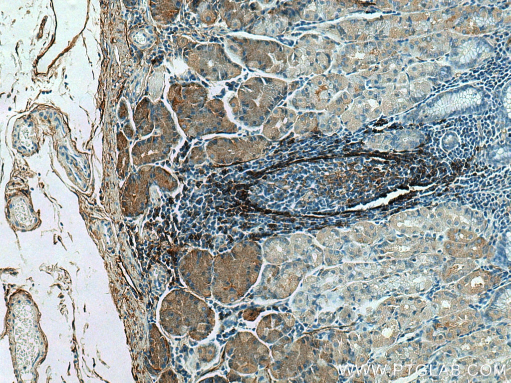 Immunohistochemistry (IHC) staining of human stomach tissue using NT5E/CD73 Polyclonal antibody (12231-1-AP)