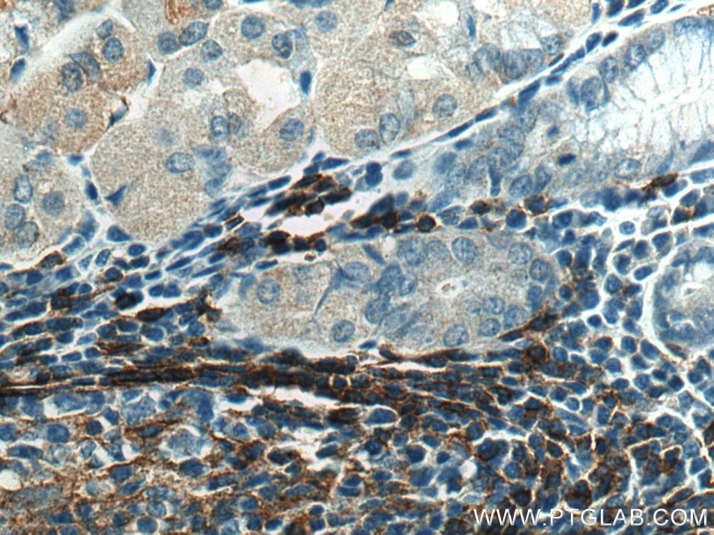 Immunohistochemistry (IHC) staining of human stomach tissue using NT5E/CD73 Polyclonal antibody (12231-1-AP)