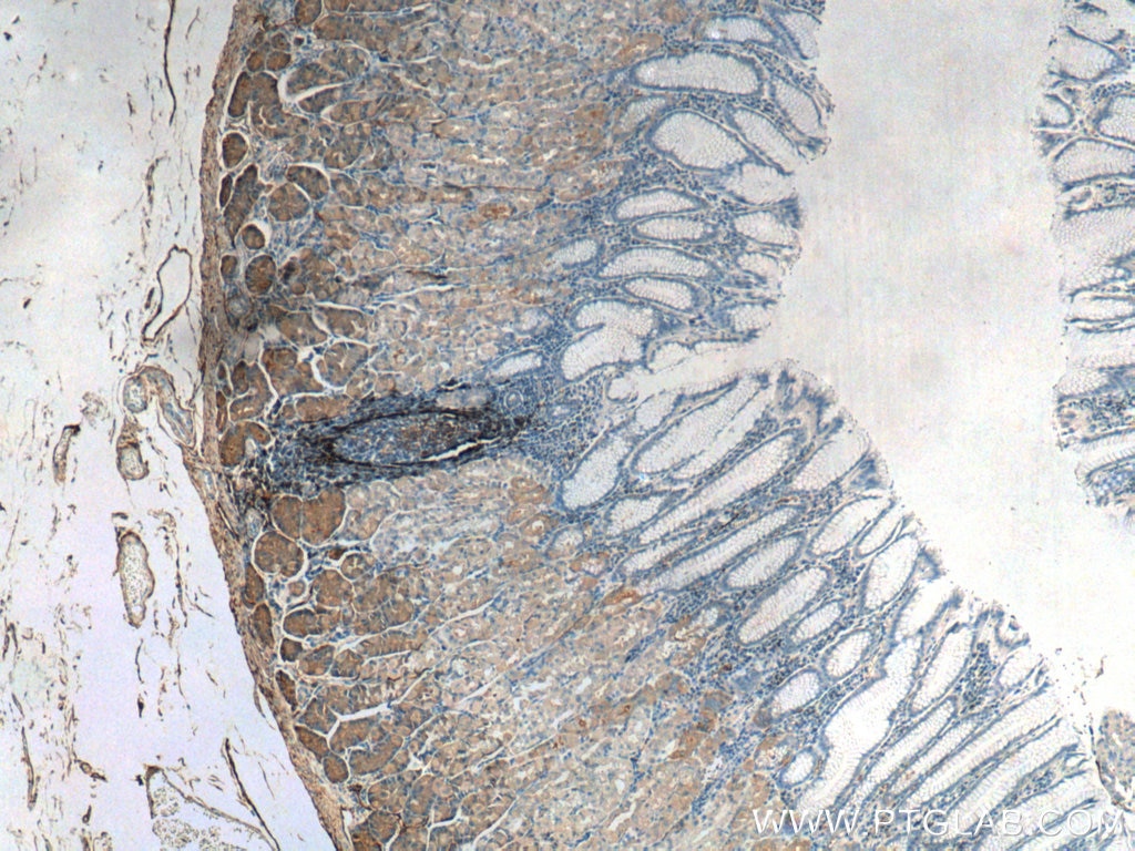 Immunohistochemistry (IHC) staining of human stomach tissue using NT5E/CD73 Polyclonal antibody (12231-1-AP)