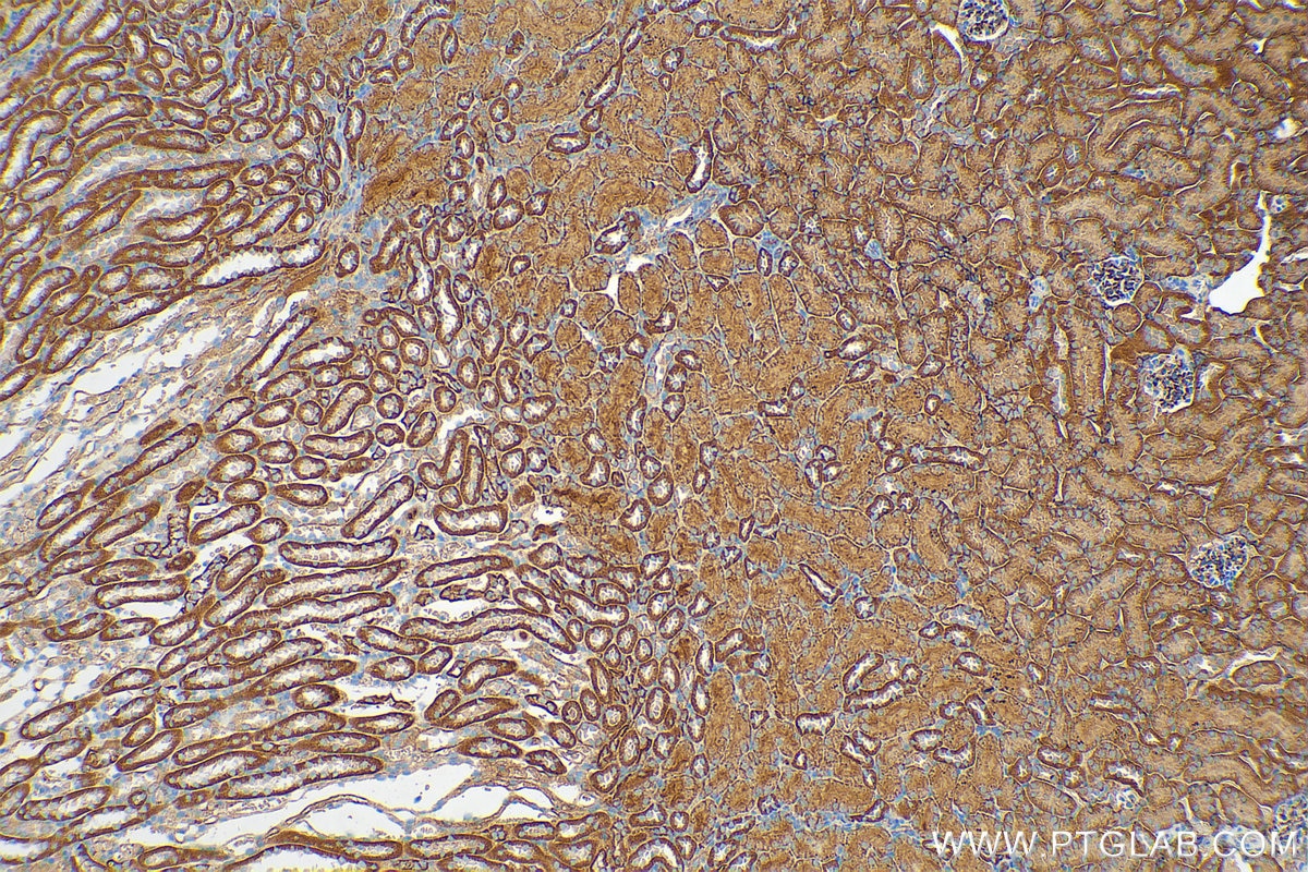 Immunohistochemistry (IHC) staining of mouse kidney tissue using NT5E/CD73 Polyclonal antibody (12231-1-AP)