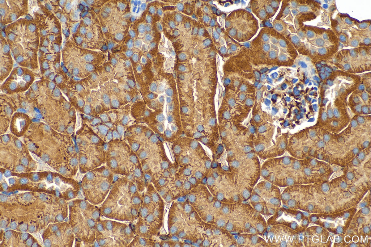 Immunohistochemistry (IHC) staining of mouse kidney tissue using NT5E/CD73 Polyclonal antibody (12231-1-AP)