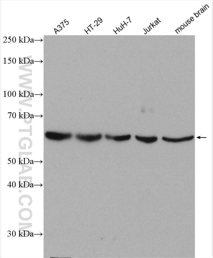 Western Blot (WB) analysis of various lysates using NT5E/CD73 Polyclonal antibody (12231-1-AP)