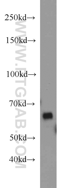 Western Blot (WB) analysis of mouse brain tissue using NT5E/CD73 Polyclonal antibody (12231-1-AP)