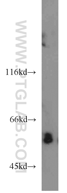 WB analysis of K-562 using 12231-1-AP