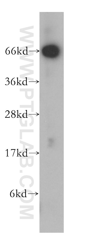 Western Blot (WB) analysis of A375 cells using NT5E/CD73 Polyclonal antibody (12231-1-AP)