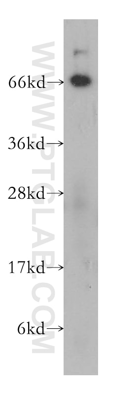 Western Blot (WB) analysis of human spleen tissue using NT5E/CD73 Polyclonal antibody (12231-1-AP)