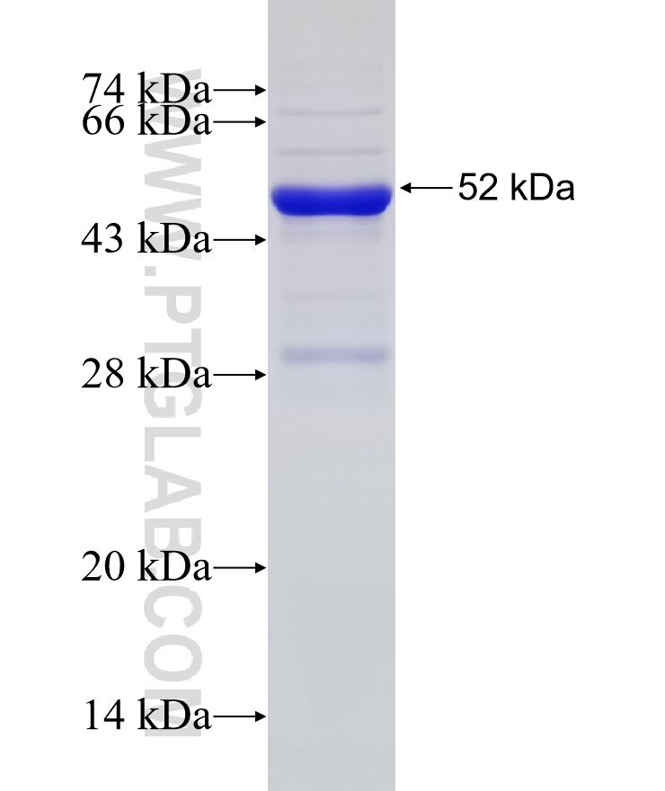 NT5E,CD73 fusion protein Ag2869 SDS-PAGE