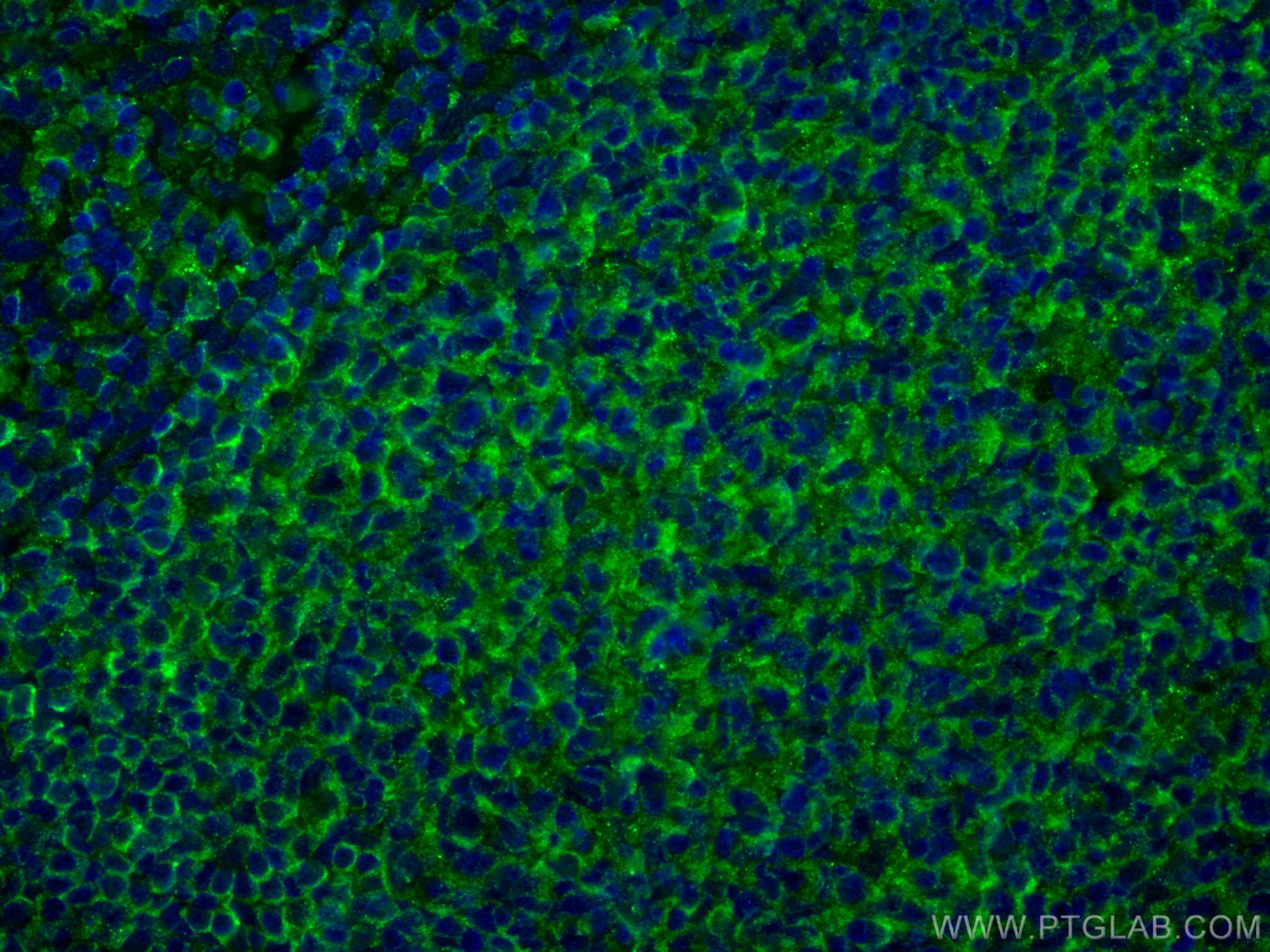Immunofluorescence (IF) / fluorescent staining of human tonsillitis tissue using NT5E,CD73 Monoclonal antibody (67789-1-Ig)