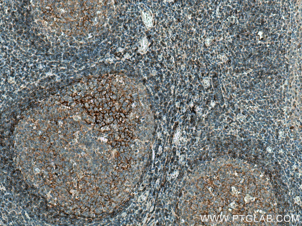 Immunohistochemistry (IHC) staining of human tonsillitis tissue using NT5E,CD73 Monoclonal antibody (67789-1-Ig)