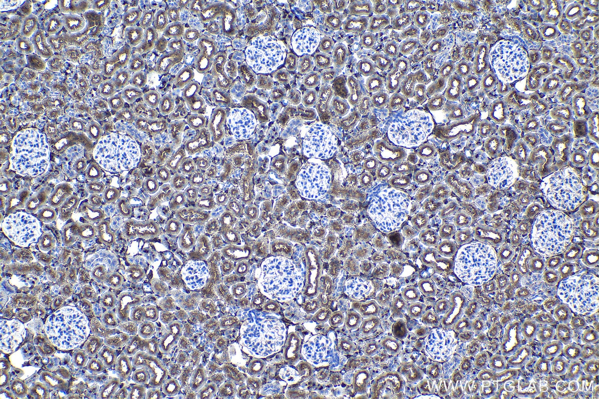 Immunohistochemistry (IHC) staining of rat kidney tissue using NT5E,CD73 Monoclonal antibody (67789-1-Ig)