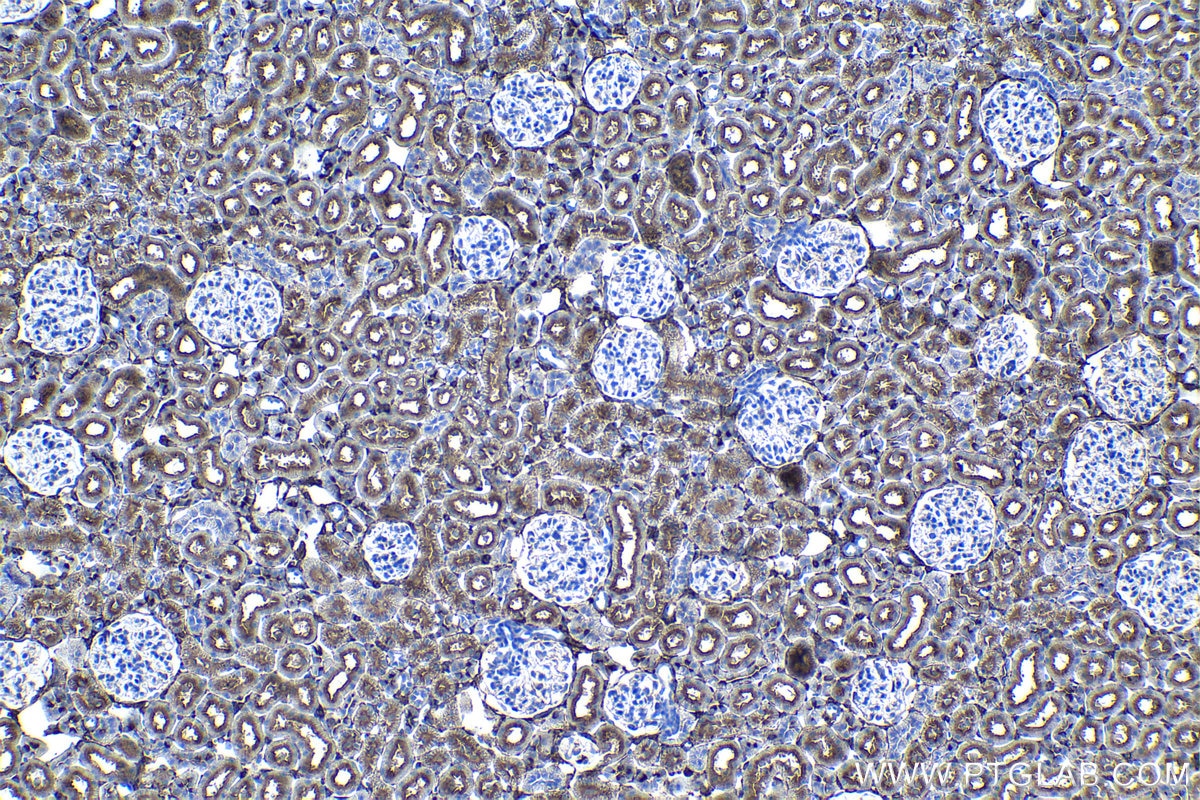 IHC staining of rat kidney using 67789-1-Ig