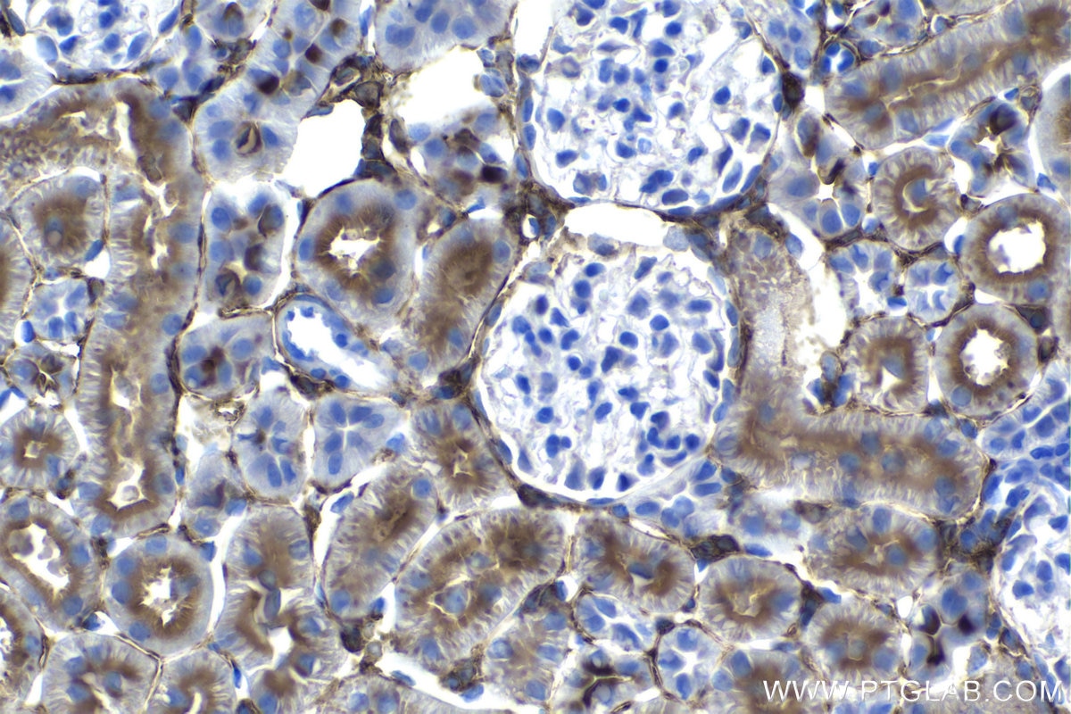 Immunohistochemistry (IHC) staining of rat kidney tissue using NT5E,CD73 Monoclonal antibody (67789-1-Ig)