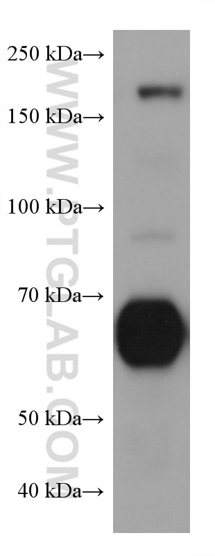 Western Blot (WB) analysis of U-87 MG cells using NT5E,CD73 Monoclonal antibody (67789-1-Ig)