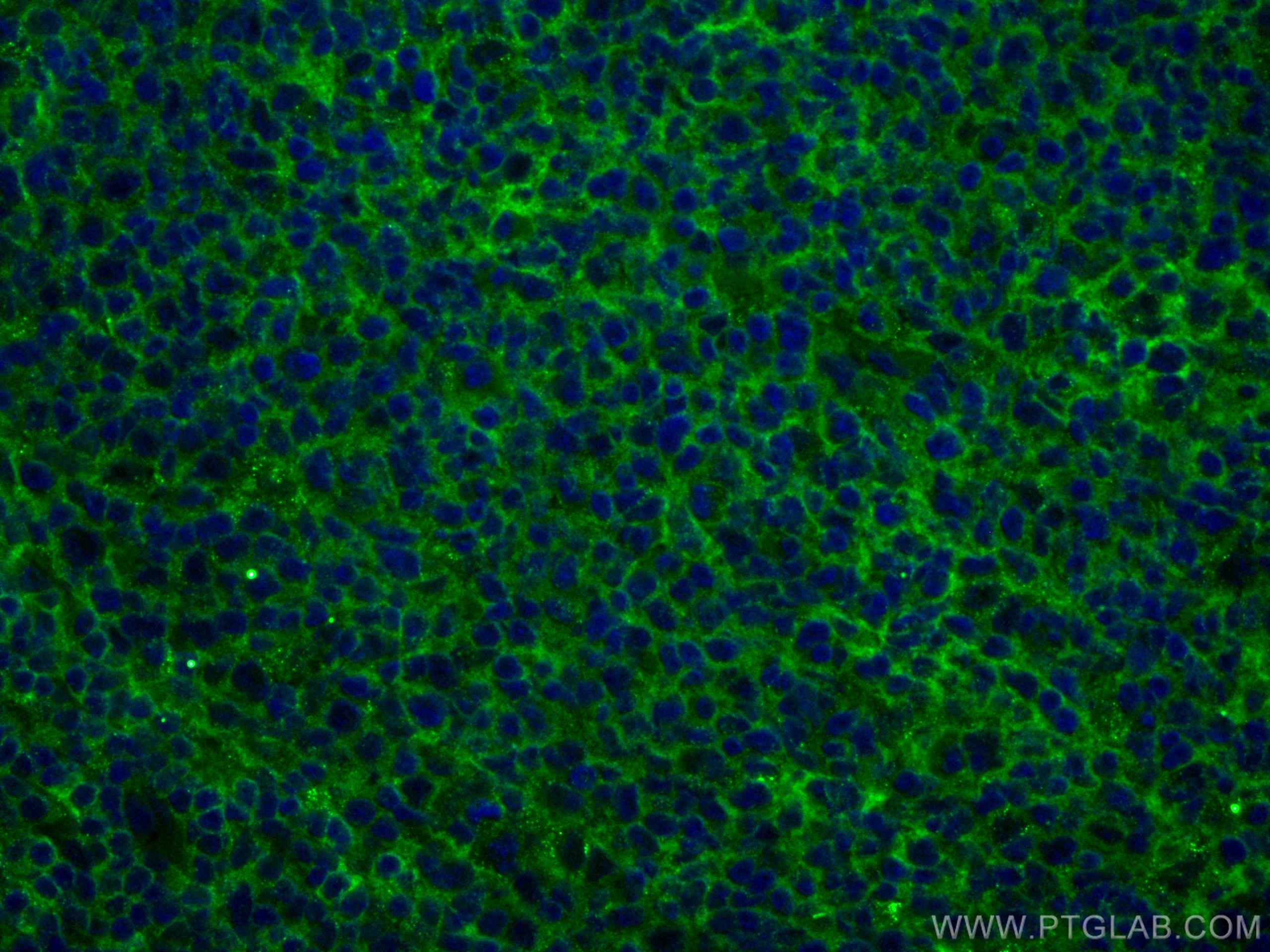 Immunofluorescence (IF) / fluorescent staining of human tonsillitis tissue using CoraLite® Plus 488-conjugated NT5E,CD73 Monoclonal (CL488-67789)