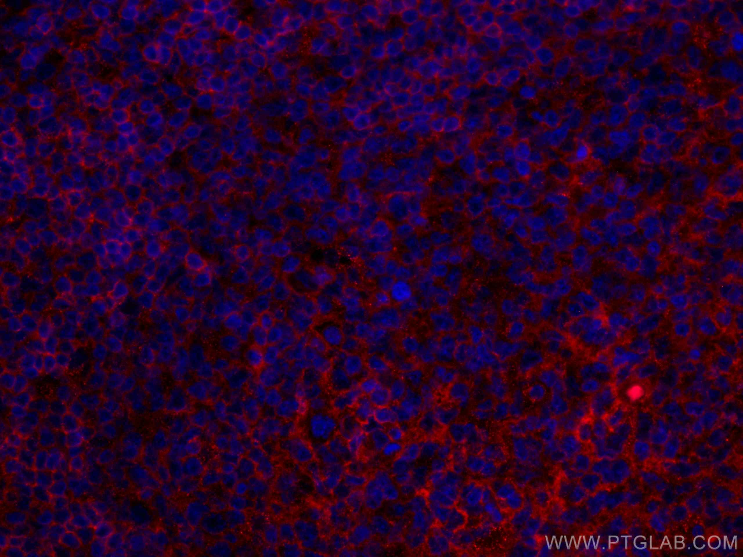Immunofluorescence (IF) / fluorescent staining of human tonsillitis tissue using CoraLite®594-conjugated NT5E,CD73 Monoclonal antib (CL594-67789)