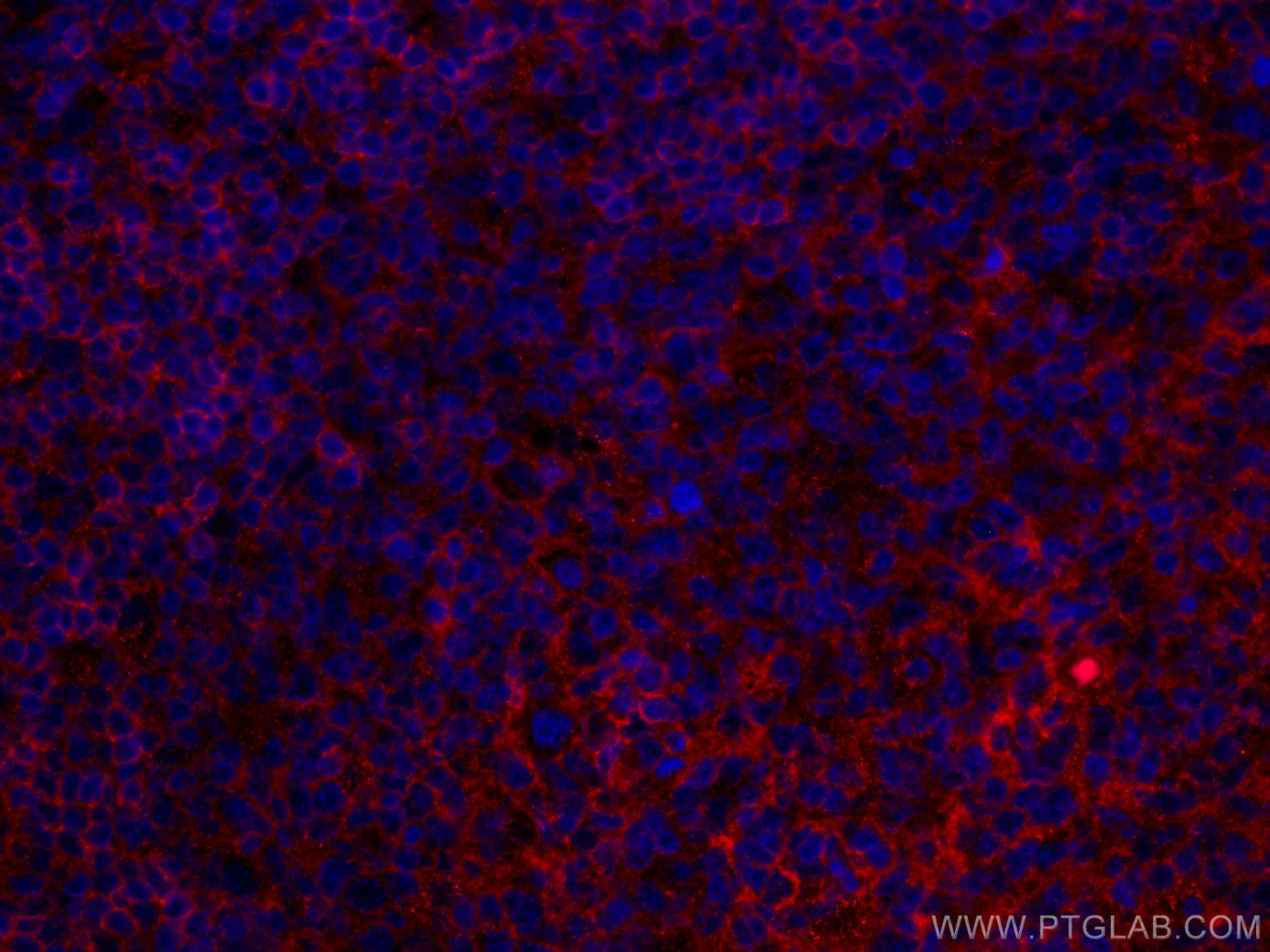 IF Staining of human tonsillitis using CL594-67789