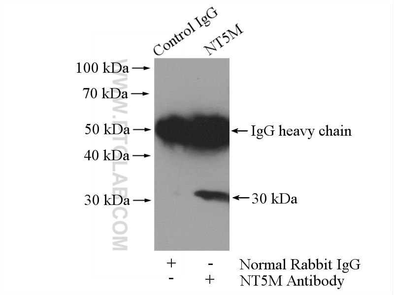 Immunoprecipitation (IP) experiment of mouse skeletal muscle tissue using NT5M Polyclonal antibody (20765-1-AP)