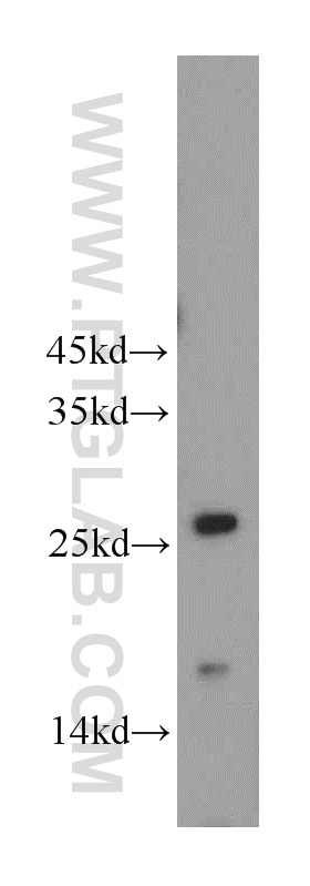 Western Blot (WB) analysis of mouse brain tissue using NT5M Polyclonal antibody (20765-1-AP)