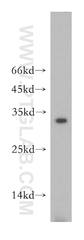 Western Blot (WB) analysis of mouse skeletal muscle tissue using NT5M Polyclonal antibody (20765-1-AP)