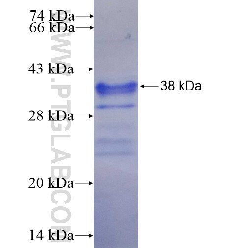 NT5M fusion protein Ag14983 SDS-PAGE