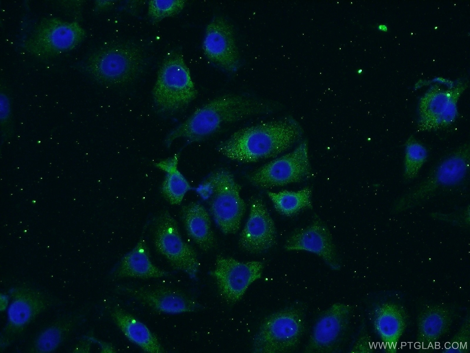 Immunofluorescence (IF) / fluorescent staining of SH-SY5Y cells using Neurotrophin 3 Polyclonal antibody (18084-1-AP)
