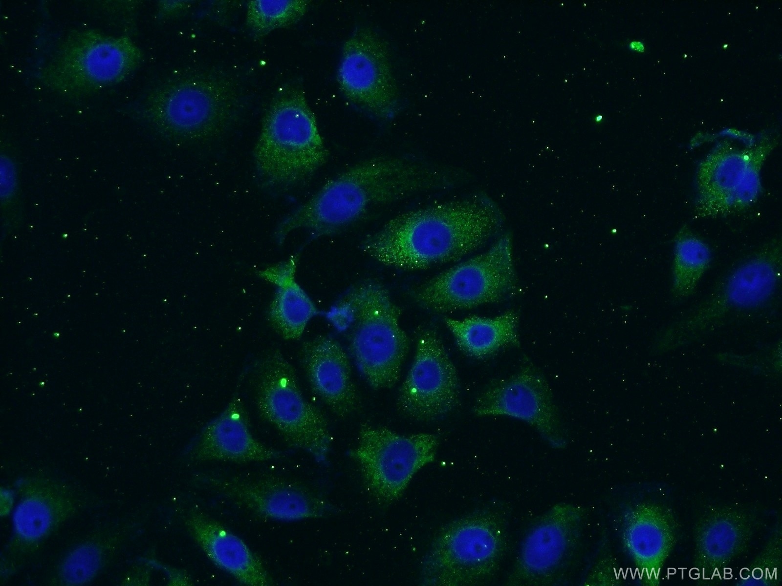 Neurotrophin 3 Polyclonal antibody