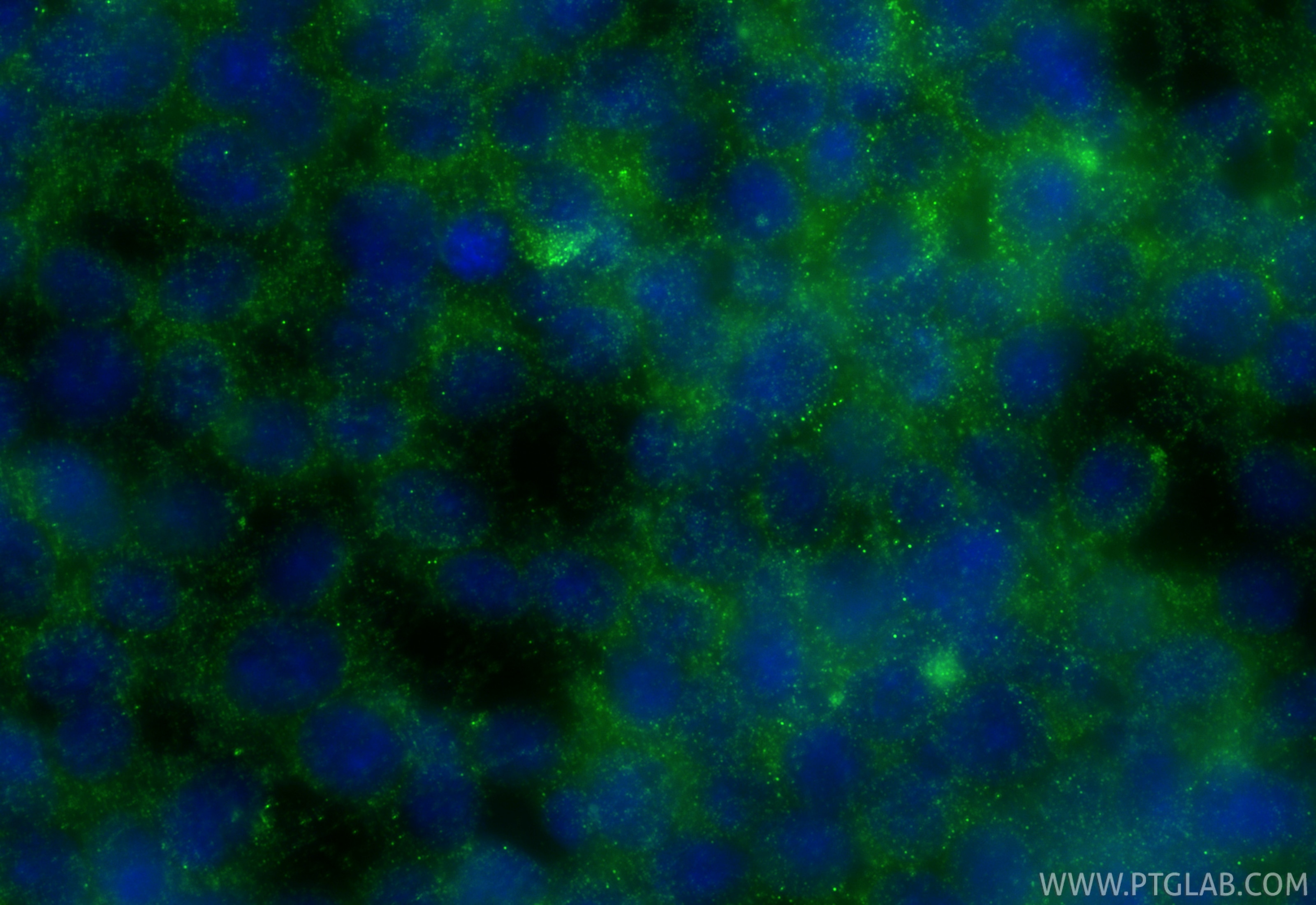 Immunofluorescent analysis of (-20°C Ethanol) fixed SH-SY5Y cells using Neurotrophin 3 antibody (18084-1-AP) at dilution of 1:200 and CoraLite®488-Conjugated Goat Anti-Rabbit IgG(H+L) (SA00013-2). Immunofluorescence (IF) / fluorescent staining of SH-SY5Y cells using Neurotrophin 3 Polyclonal antibody (18084-1-AP)