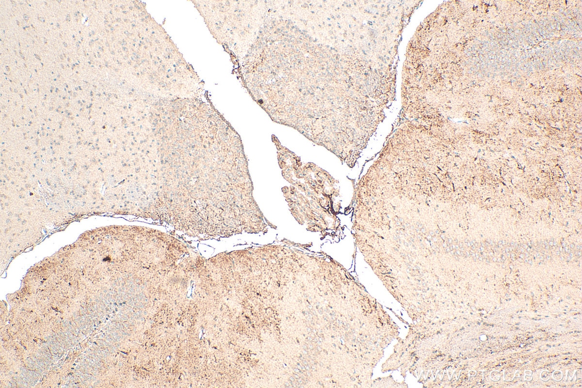 Immunohistochemistry (IHC) staining of mouse brain tissue using Neurotrophin 3 Polyclonal antibody (18084-1-AP)