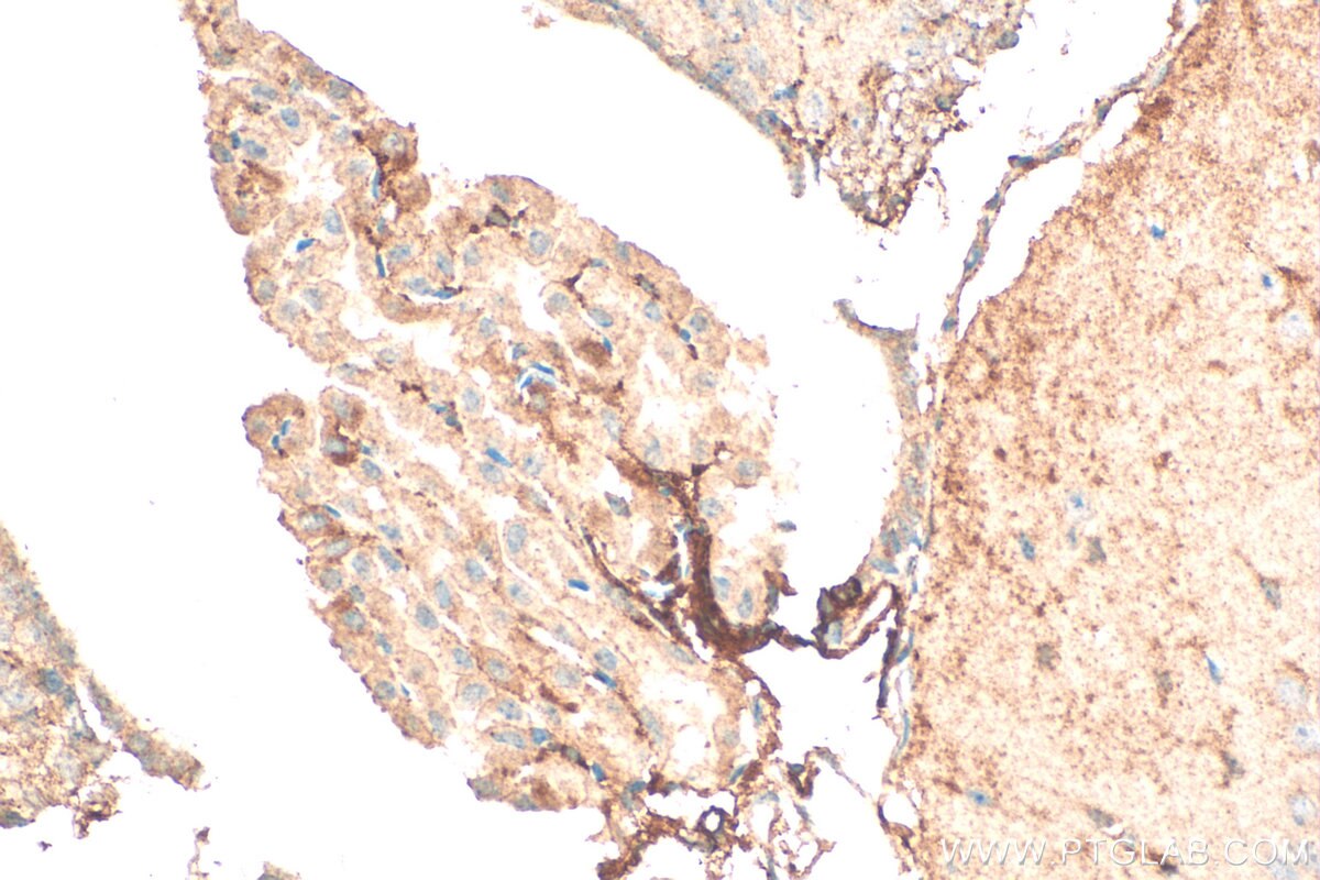 Immunohistochemistry (IHC) staining of mouse brain tissue using Neurotrophin 3 Polyclonal antibody (18084-1-AP)