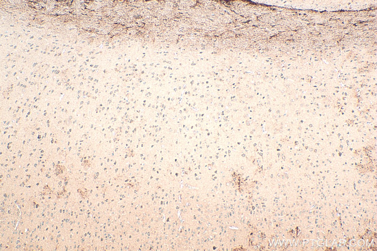 Immunohistochemistry (IHC) staining of mouse brain tissue using Neurotrophin 3 Polyclonal antibody (18084-1-AP)