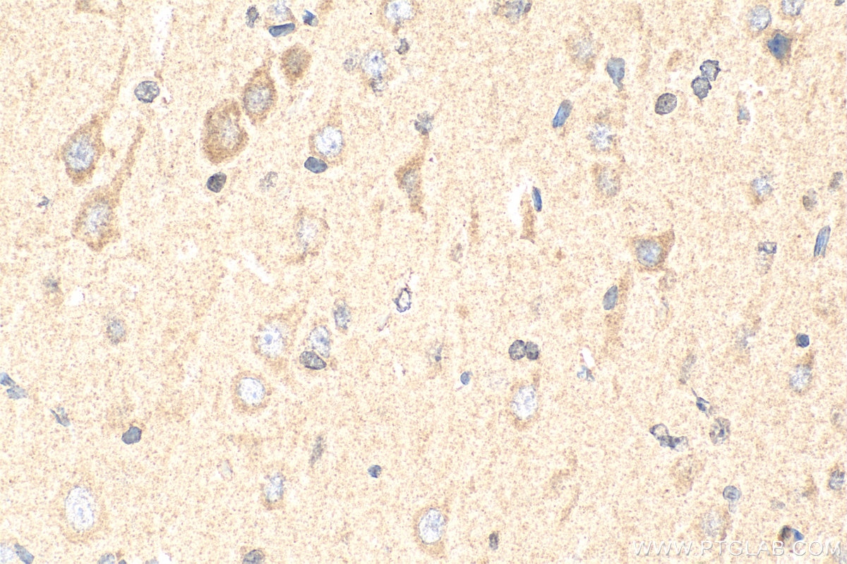 Immunohistochemistry (IHC) staining of rat brain tissue using Neurotrophin 3 Polyclonal antibody (18084-1-AP)