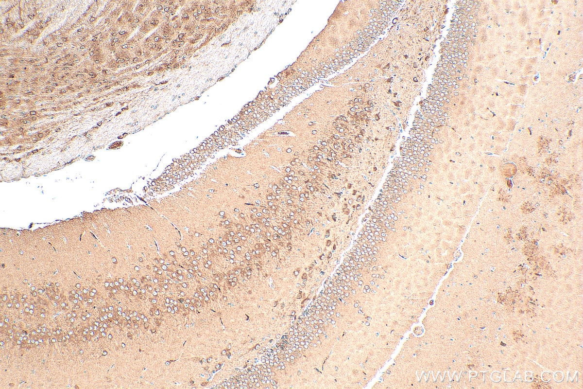 Immunohistochemistry (IHC) staining of mouse brain tissue using Neurotrophin 3 Polyclonal antibody (18084-1-AP)
