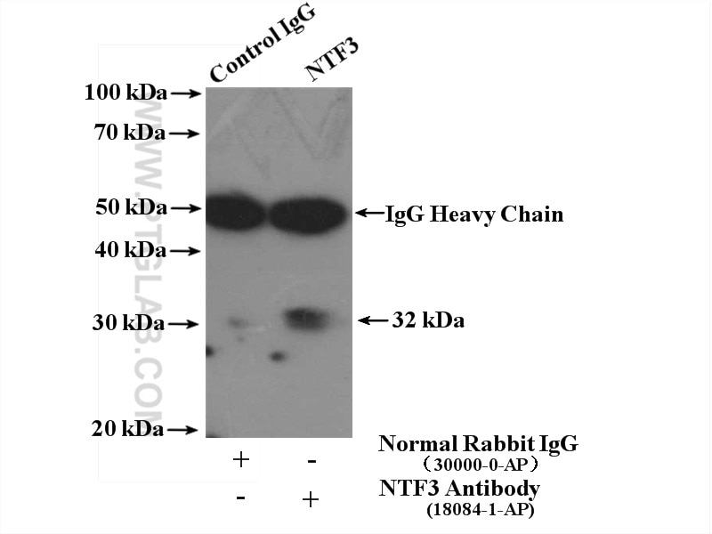 Immunoprecipitation (IP) experiment of SH-SY5Y cells using Neurotrophin 3 Polyclonal antibody (18084-1-AP)