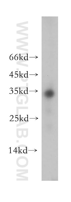 WB analysis of human placenta using 18084-1-AP