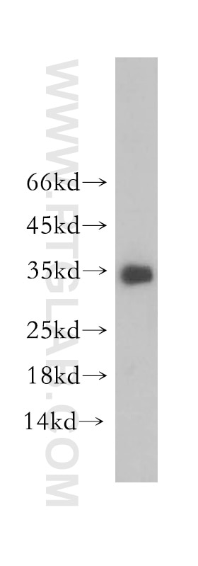 Western Blot (WB) analysis of SH-SY5Y cells using Neurotrophin 3 Polyclonal antibody (18084-1-AP)