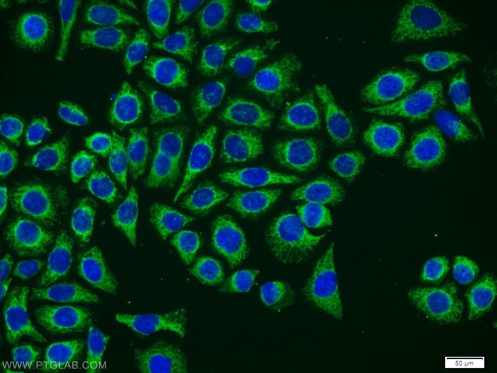 Immunofluorescence (IF) / fluorescent staining of PC-3 cells using Neurotrophin 4 Polyclonal antibody (12297-1-AP)