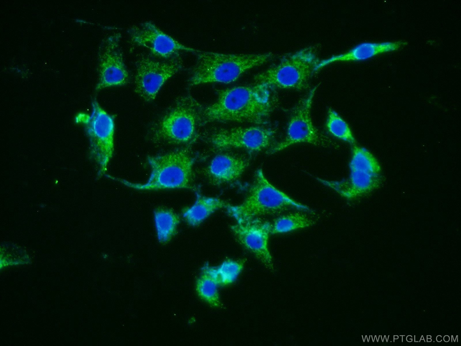 Immunofluorescence (IF) / fluorescent staining of SH-SY5Y cells using Neurotrophin 4 Polyclonal antibody (12297-1-AP)