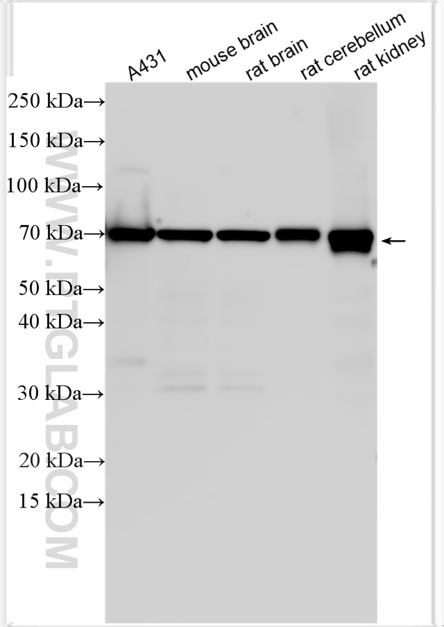 Western Blot (WB) analysis of various lysates using Neurotrophin 4 Polyclonal antibody (12297-1-AP)