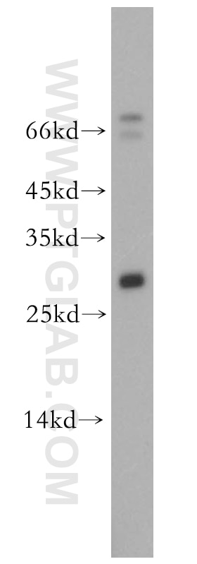 Neurotrophin 4 Polyclonal antibody