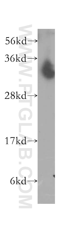 Western Blot (WB) analysis of human brain tissue using NTHL1 Polyclonal antibody (11154-1-AP)