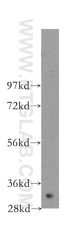 Western Blot (WB) analysis of human brain tissue using NTHL1 Polyclonal antibody (11154-1-AP)