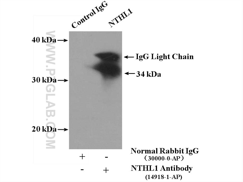 Immunoprecipitation (IP) experiment of Y79 cells using NTHL1 Polyclonal antibody (14918-1-AP)