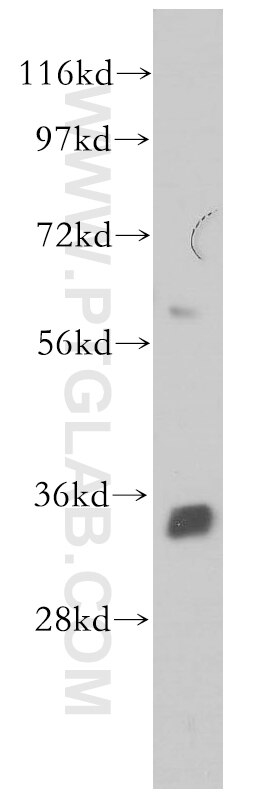 Western Blot (WB) analysis of Y79 cells using NTHL1 Polyclonal antibody (14918-1-AP)