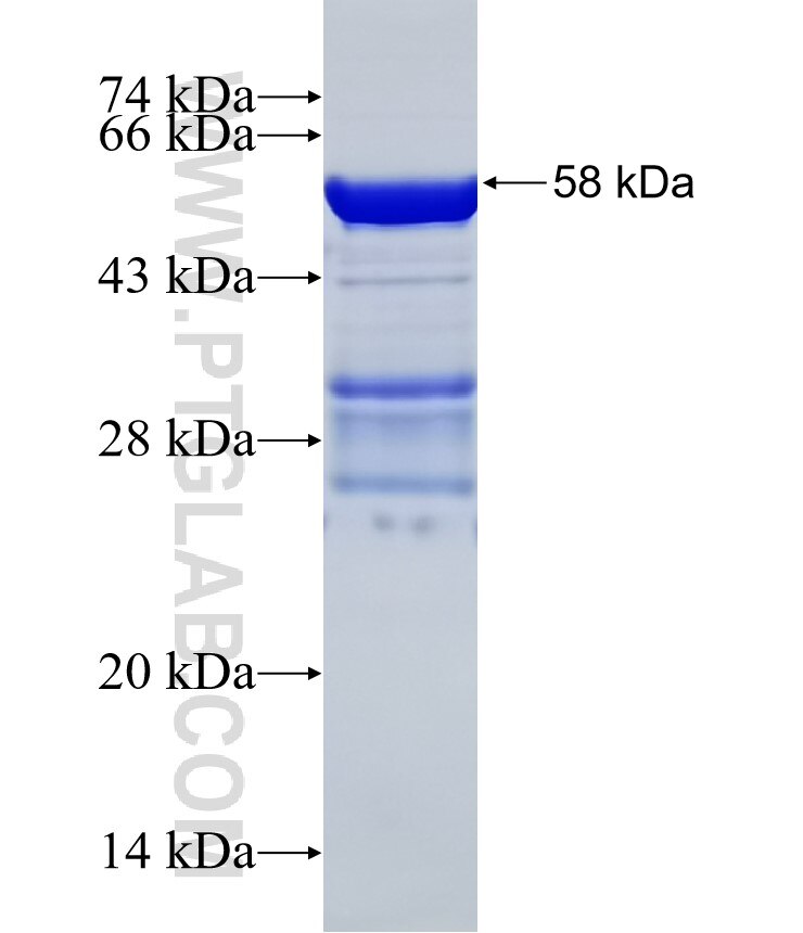 NTHL1 fusion protein Ag1631 SDS-PAGE