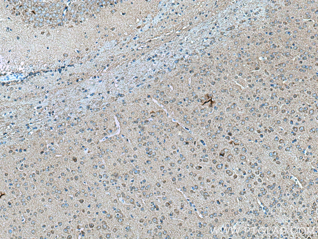 Immunohistochemistry (IHC) staining of mouse brain tissue using NTM Polyclonal antibody (14373-1-AP)