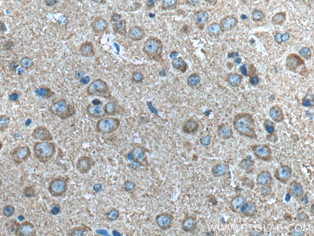 Immunohistochemistry (IHC) staining of mouse brain tissue using NTM Polyclonal antibody (14373-1-AP)