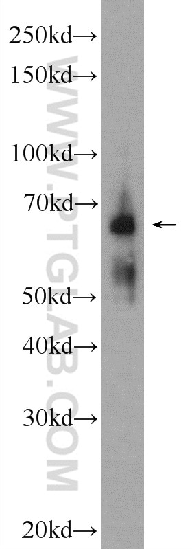 Western Blot (WB) analysis of mouse brain tissue using NTM Polyclonal antibody (14373-1-AP)