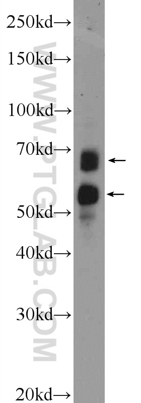 Western Blot (WB) analysis of SH-SY5Y cells using NTM Polyclonal antibody (14373-1-AP)